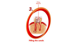 what is endodontics