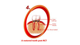 what is endodontics